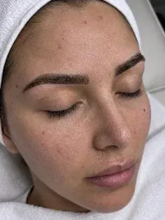 Before: Congestion and texture